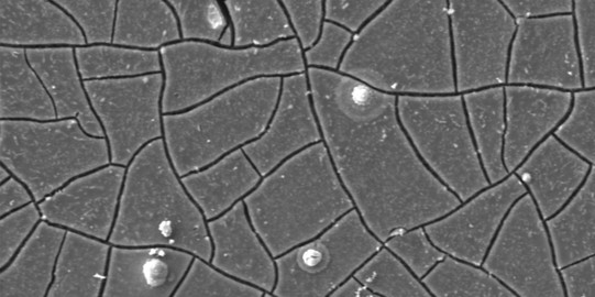 Vorschaubild Forschungsprojekt Magnesium-Implantate